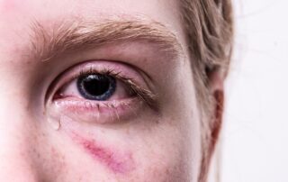 Dunkelfeldbefragung zu geschlechtsspezifischer Gewalt